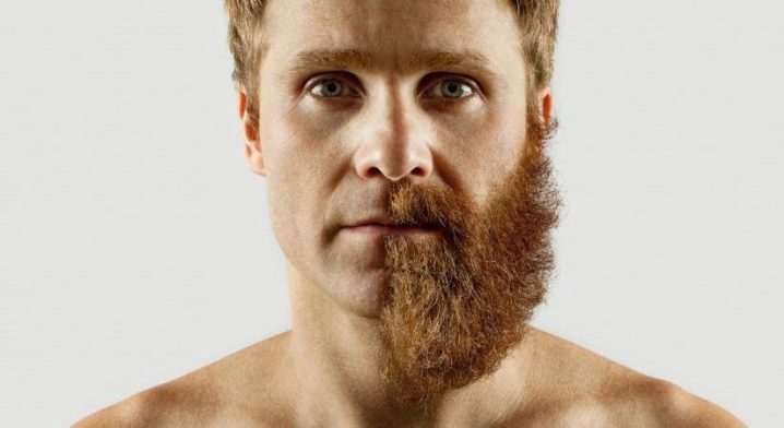 A barba cresce de forma desigual: causas, tratamento e cuidados