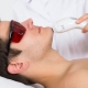 Remoção de pêlos faciais a laser masculino
